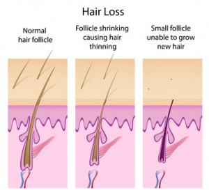 Hair Follicle Sensitivity