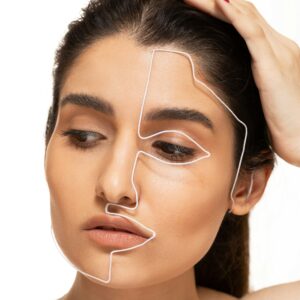 Microneedling with PRP