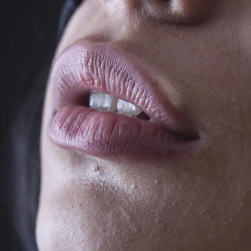 Muscle Relaxers & Treatment for Rejuvenating Facial Skin