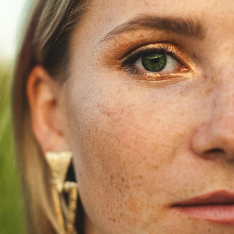 Acne Clinic in NYC for Scar Removal & Skin Care Treatments